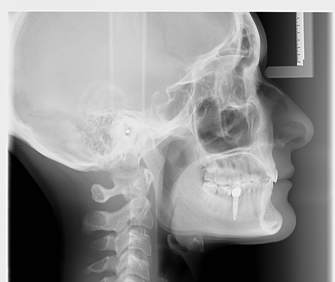 Telerradiografía